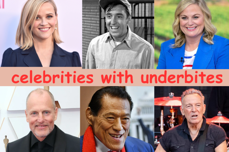 12 Celebrities with Great Underbites 
