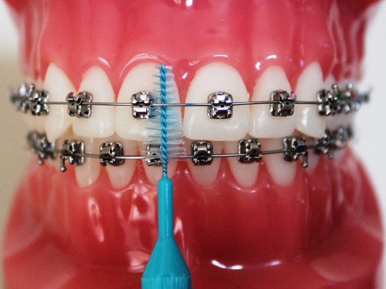 Orthodontics in the News: Global Happenings