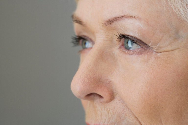Your Guide to Choosing the Right Filler for Crows Feet: What to Look for and Avoid