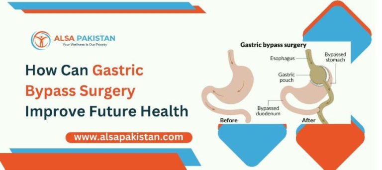 How can Gastric Bypass Surgery Improve Future Health?